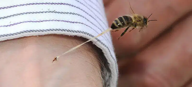 Kako postupiti ako vas ubode pčela, osa, bumbar ili stršljen,