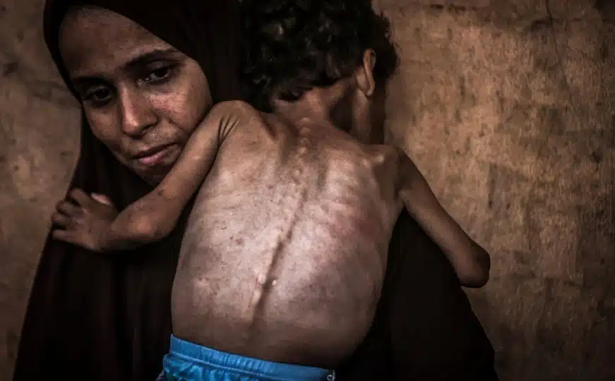 Skupština i Vlada KS uporedili Gazu sa Srebrenicom: Svijet nijemo